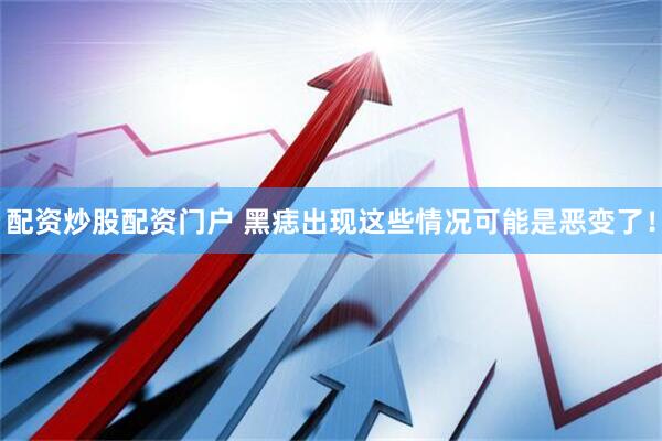 配资炒股配资门户 黑痣出现这些情况可能是恶变了！